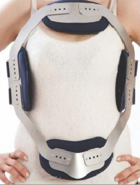 SL 912 Orthosis frame hyperextension "SWEET"