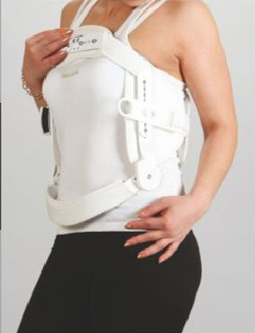 SL 915 Orthosis framework hyperextension